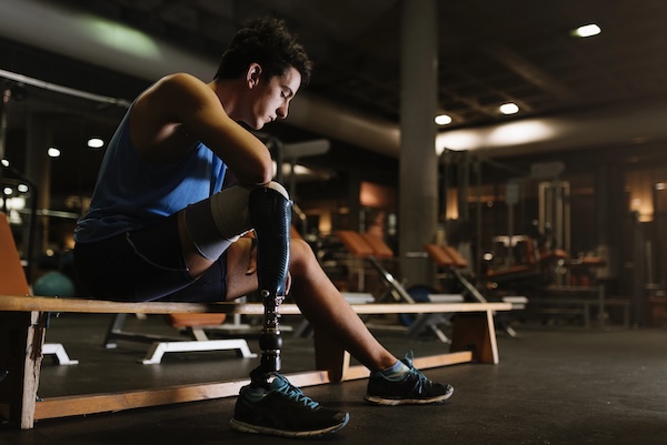 Catastrophic Leg Injury Lawyer